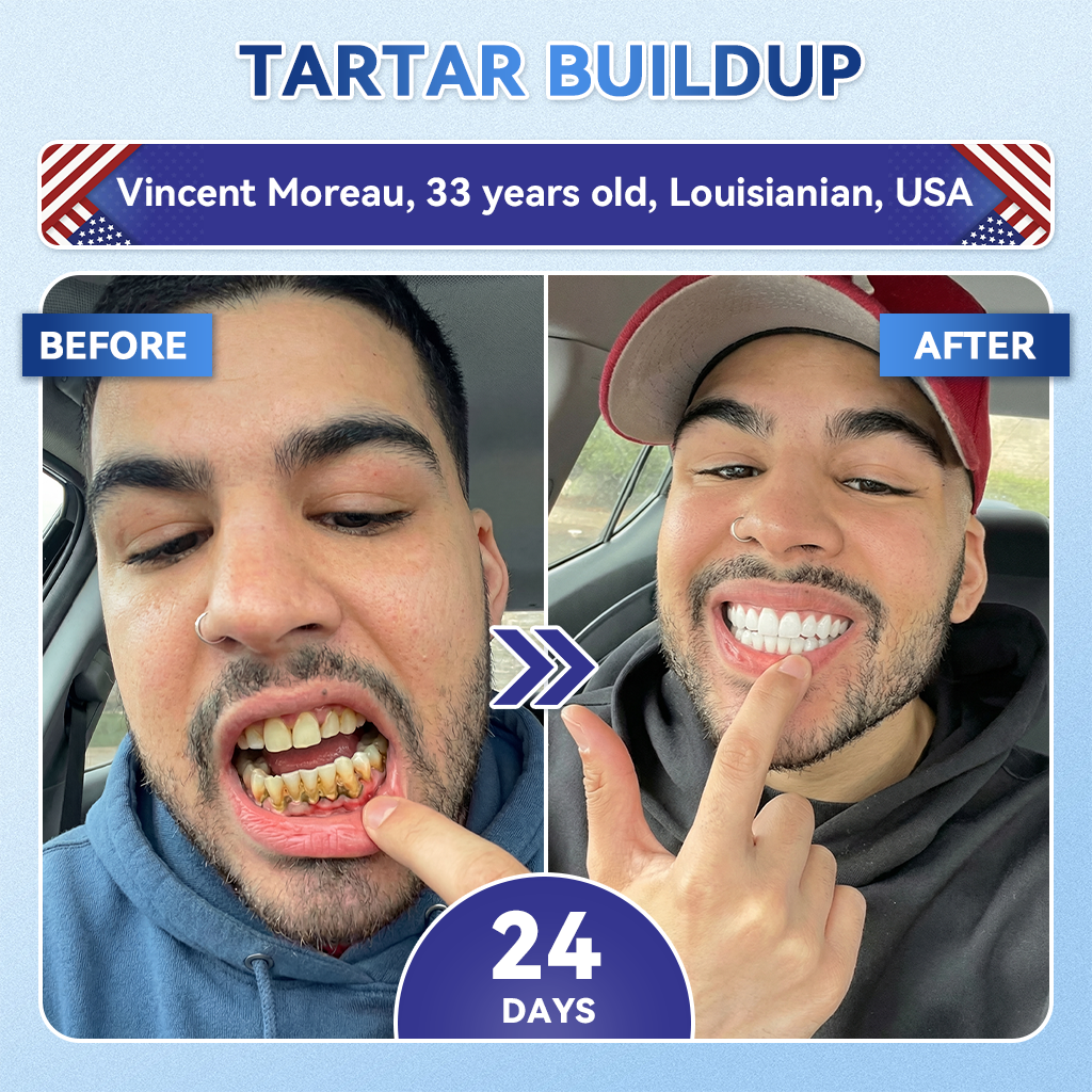 QIAWI® 🦷 Tideglusib Fast‑Dissolving Tooth & Gum Repair Oral Strips 😁 (Supports tooth repair and helps relieve gum discomfort and other common oral concerns)