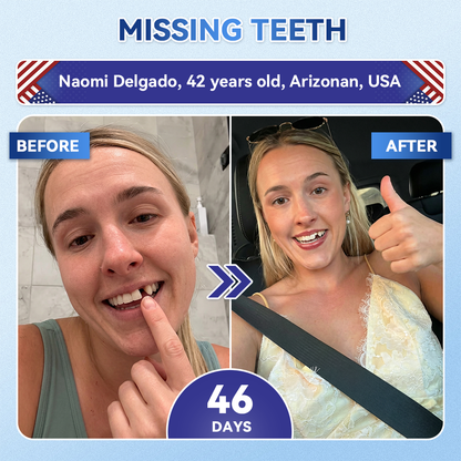 QIAWI® 🦷 Tideglusib Fast‑Dissolving Tooth & Gum Repair Oral Strips 😁 (Supports tooth repair and helps relieve gum discomfort and other common oral concerns)